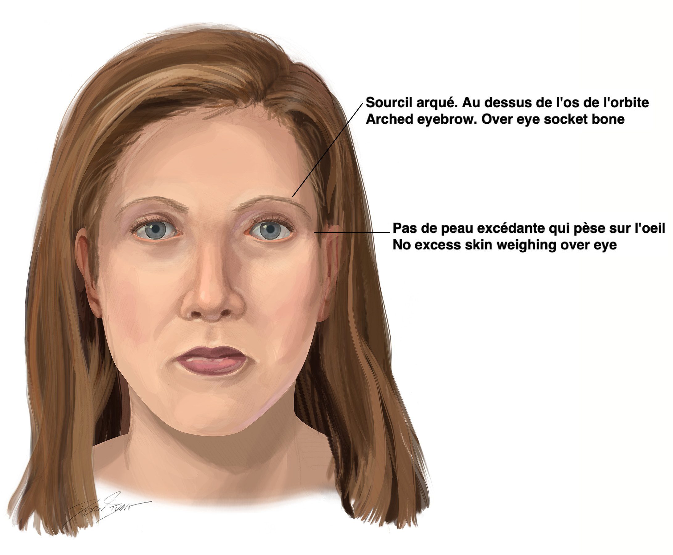 Figure 1 (a): Schematic of young woman with ideal brow showing arch and position over the eye socket