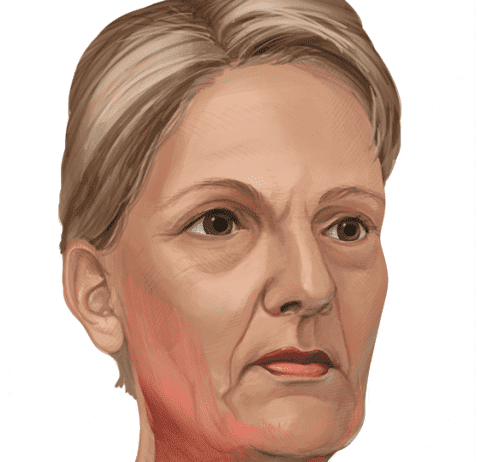 figure-1-Vieillissement du visage